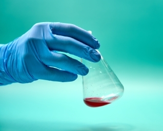 Dans quels cas choisir un mazout additivé plutôt qu’un mazout standard ?